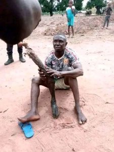 Mortician Arrested for Using Human Leg as Walking Stick, Sparks Outrage