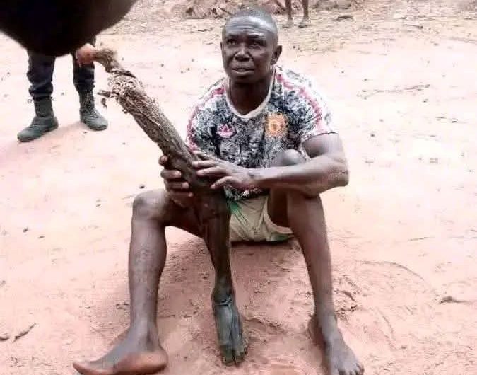 Mortician Arrested for Using Human Leg as Walking Stick, Sparks Outrage